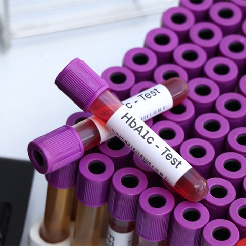HbA1c Test (Glycosylated Hb) - Blood Glucose