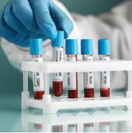 Laboratory Services