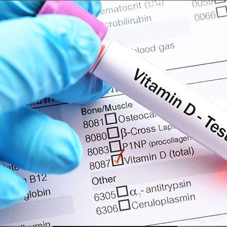 25 OH Vitamin-D Total