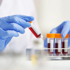 Lipid Profile (Triglycerides) - Cholesterol Testing Dr Essa Laboratory and Diagnostic Centre