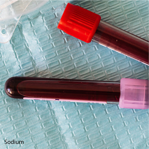 Sodium Dr Essa Laboratory and Diagnostic Centre