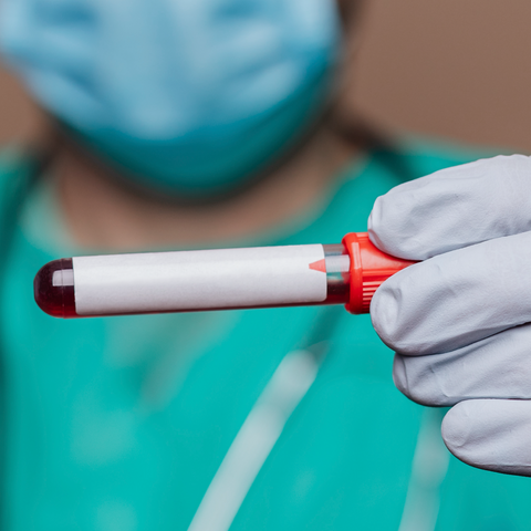 Thyroid-Stimulating Hormone (TSH): TSH Levels Test Dr Essa Laboratory and Diagnostic Centre