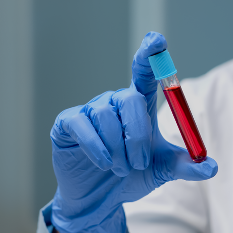 HBs Ag Dr Essa Laboratory and Diagnostic Centre