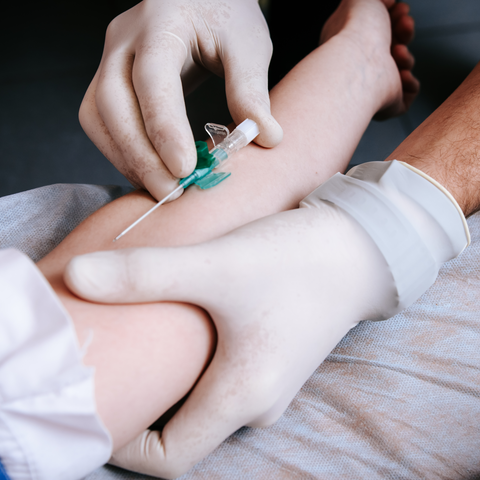 Platelet Count Dr Essa Laboratory and Diagnostic Centre