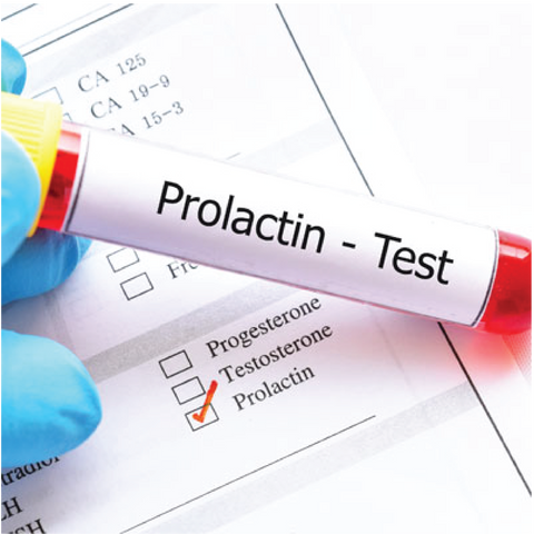 Prolactin Dr Essa Laboratory and Diagnostic Centre