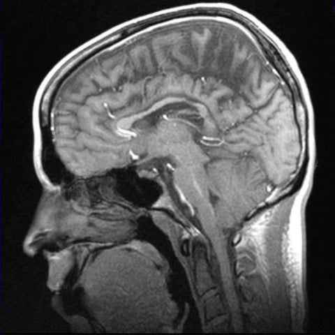 MRI Face with Contrast EssaLaboratory