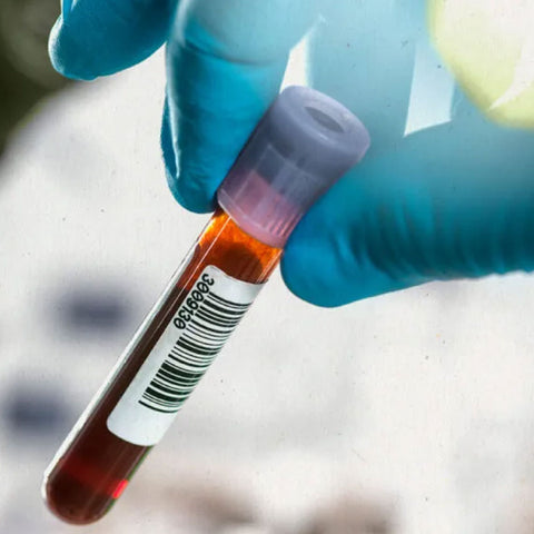 Urea Dr Essa Laboratory and Diagnostic Centre