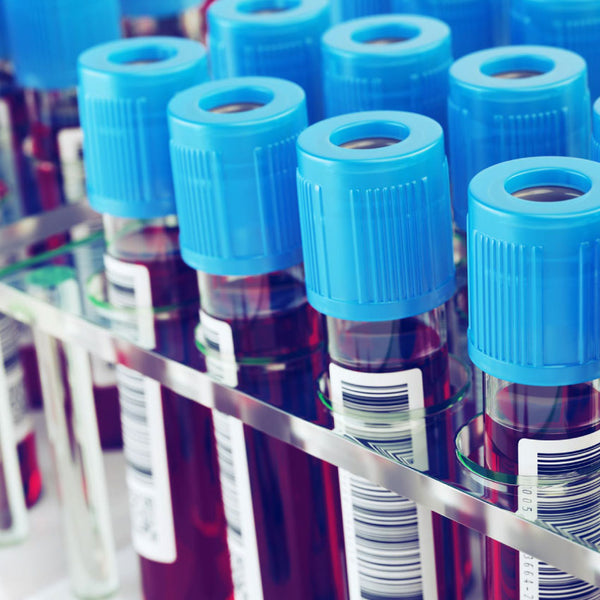 Erythrocyte Sedimentation rate (CBC ESR) – Blood Test