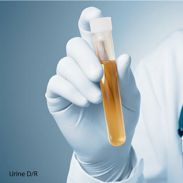Urinary Analysis - Urine Detailed Report D/R