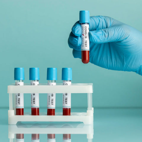 SAR-COV-2 IgM/IgG (Covid) EssaLaboratory