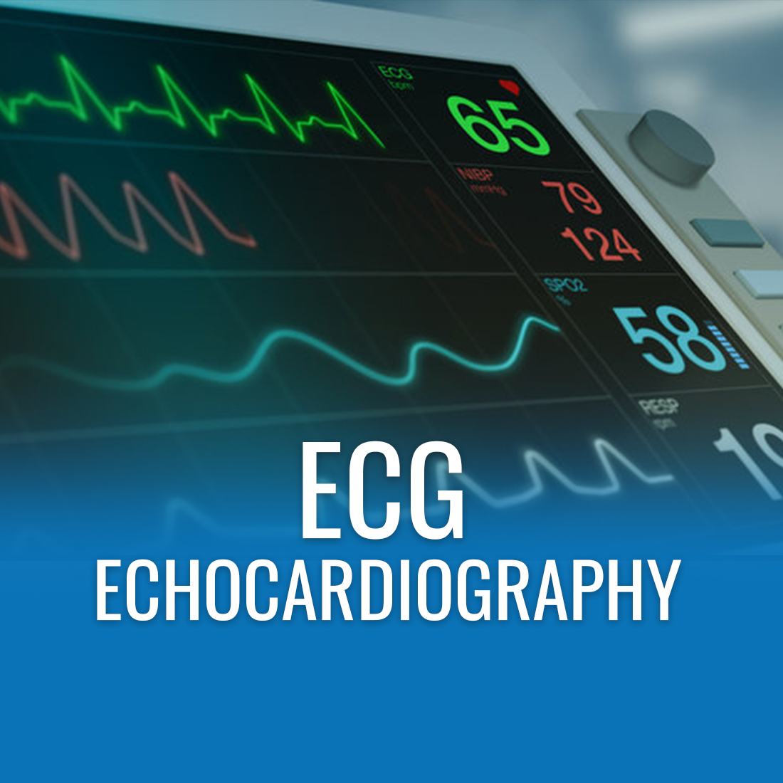 ECG – EssaLaboratory