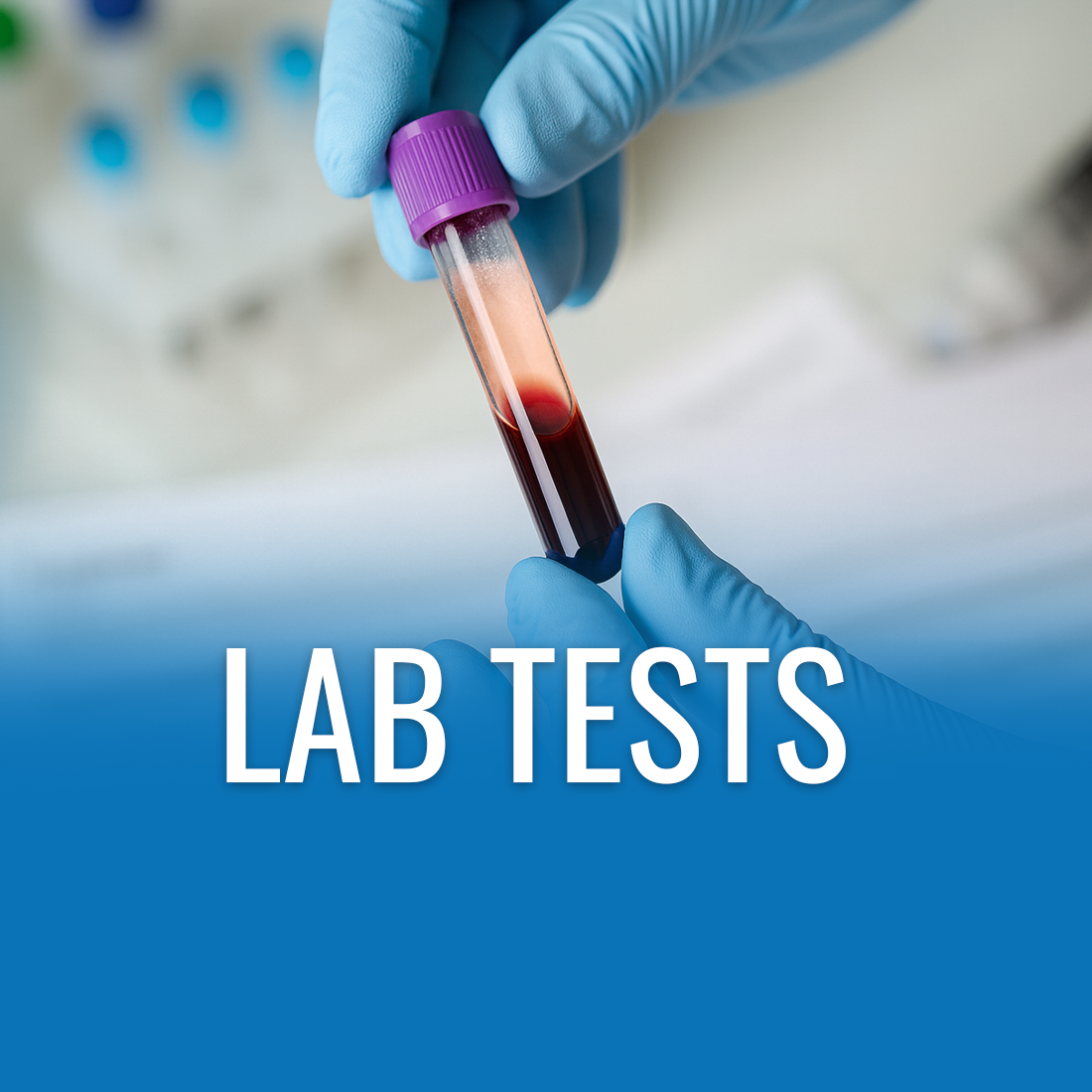 Test La Lab Lab test – EssaLaboratory