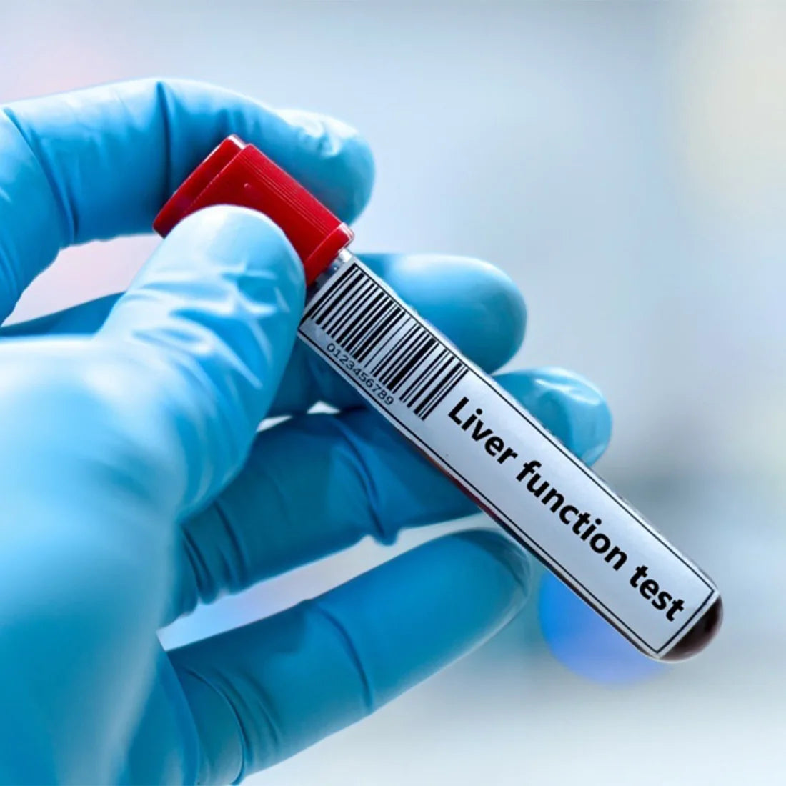 Liver Functions Test - LFT