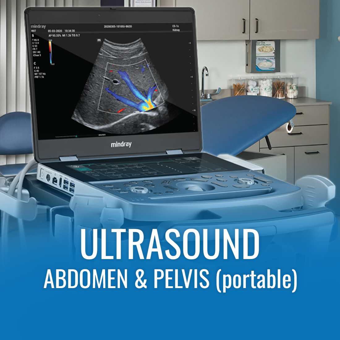U/S Abdomen & Pelvis - (Portable)