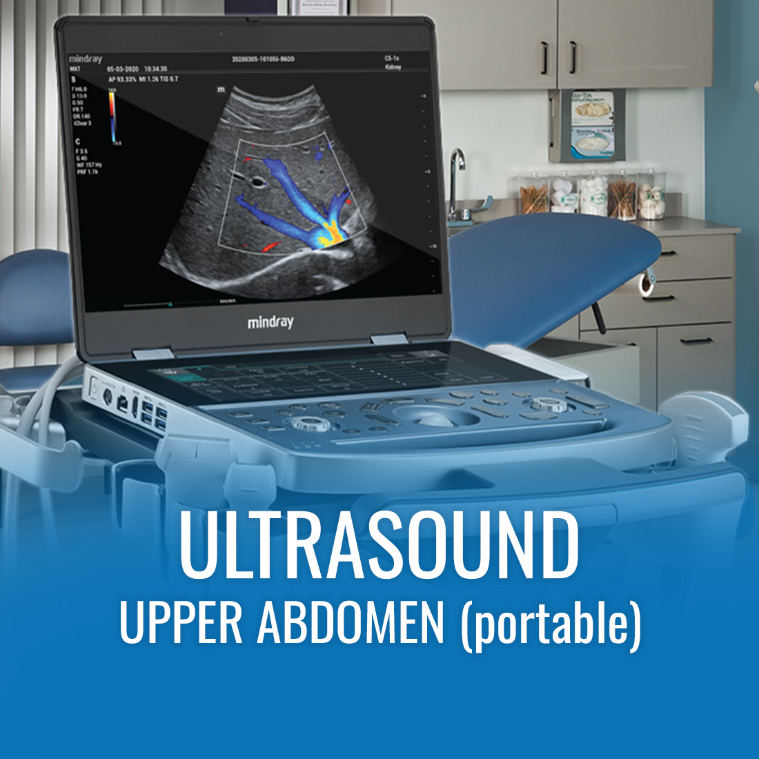 U/S Upper abdomen - (Portable)