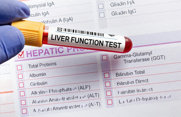 Liver Functions Test - LFT