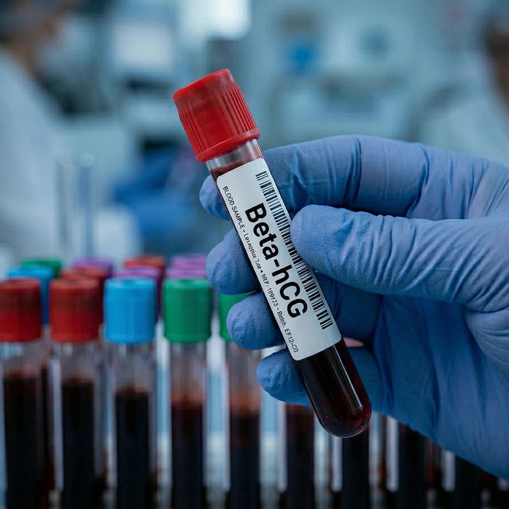 Beta hCG Test (Pregnancy Blood Test)