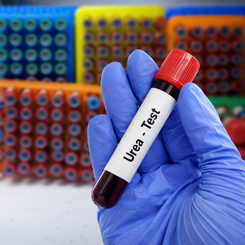Urea Test