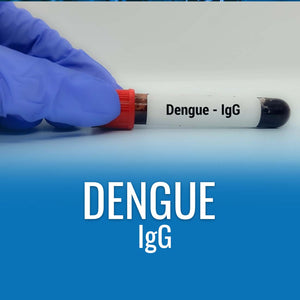 Dengue IgG Antibody