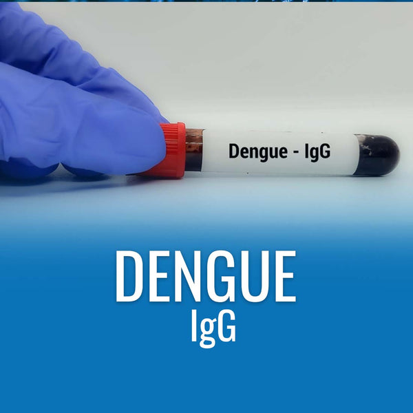 Dengue IgG Antibody