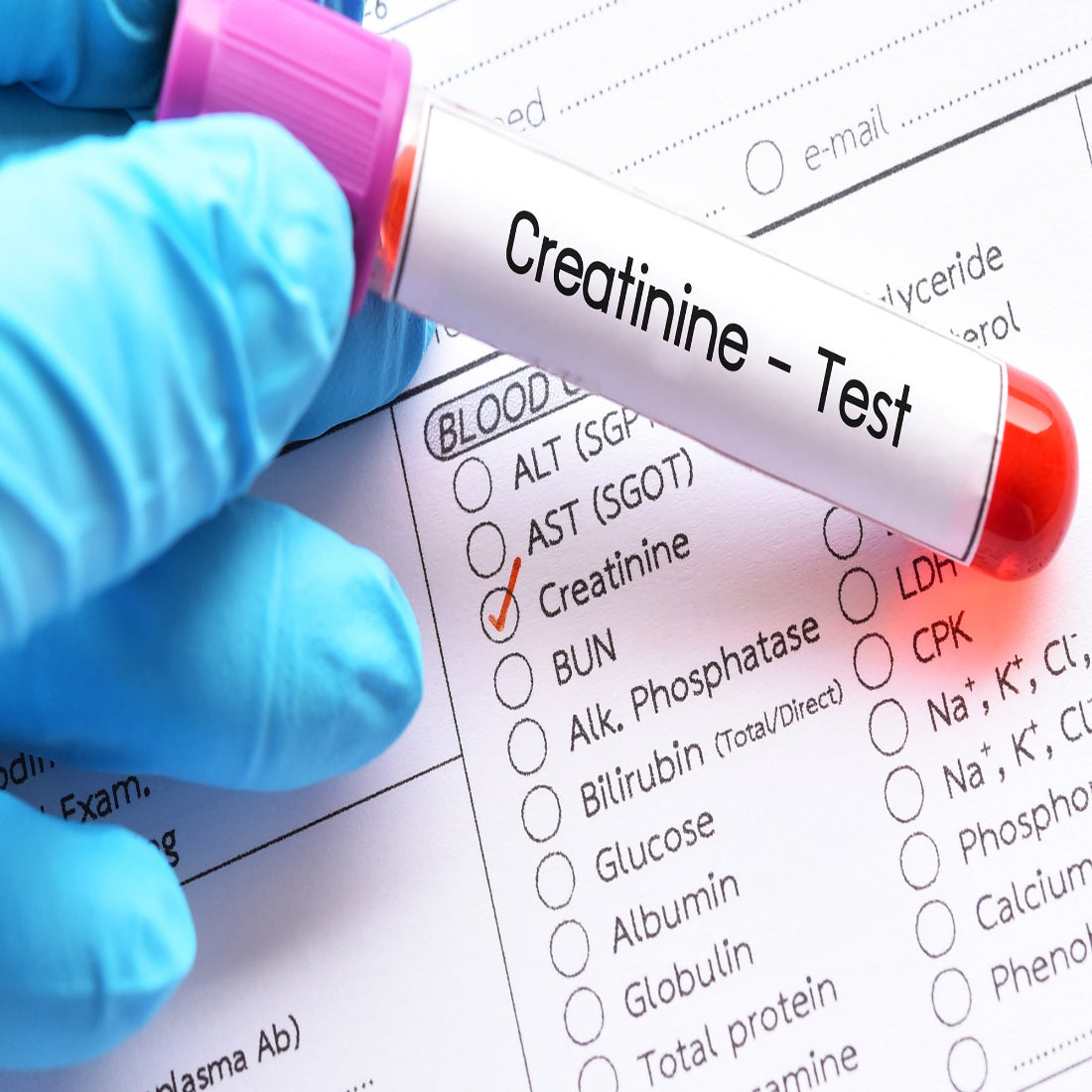 Crea Lab Test Lab test – EssaLaboratory