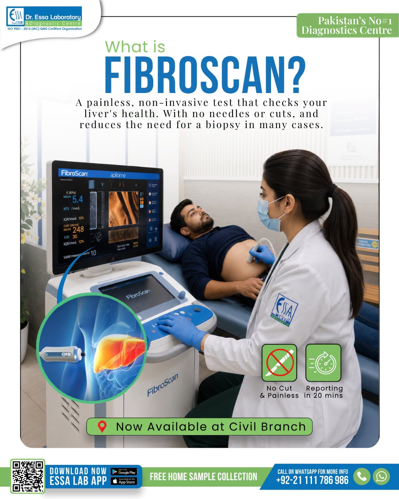 Fibroscan