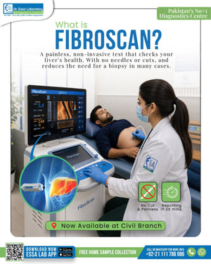 Fibroscan