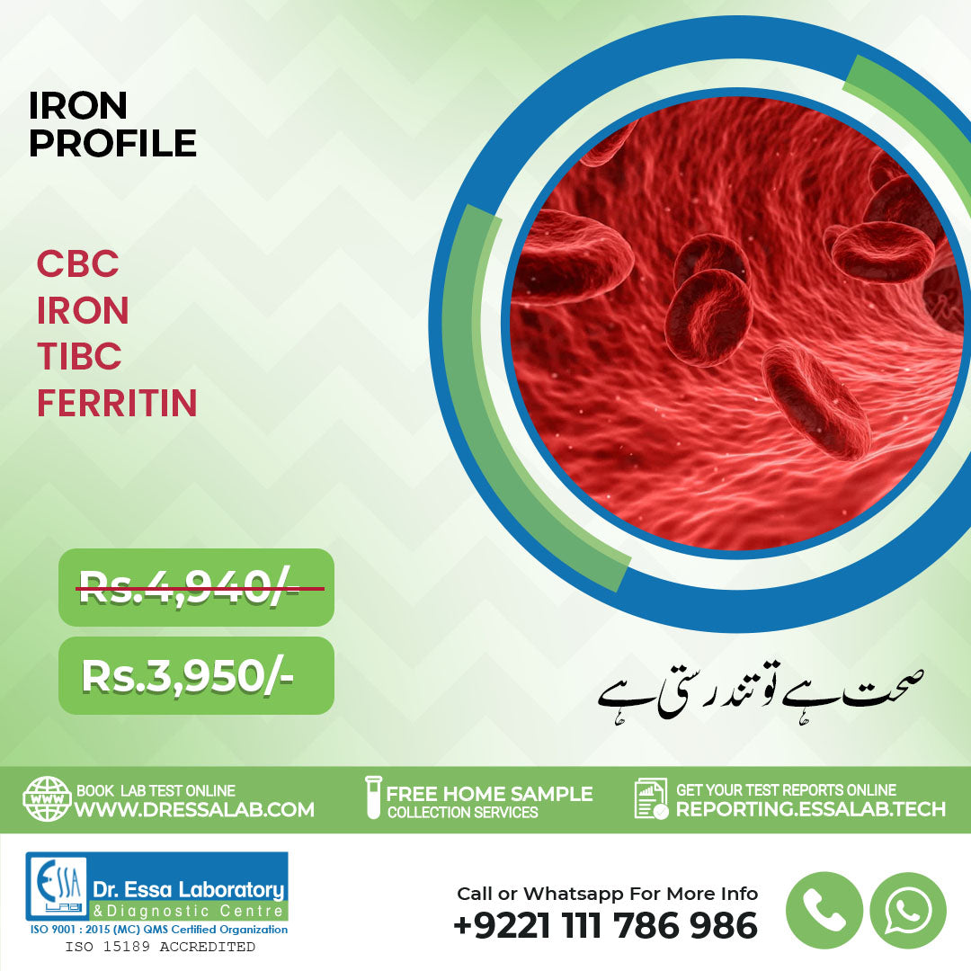 Complete Iron Profile Package