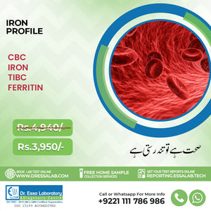 Complete Iron Profile Package