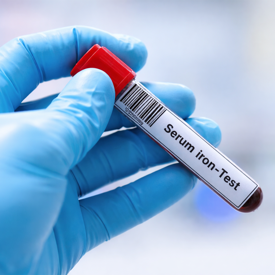Iron Test - Dr Essa Laboratory – EssaLaboratory