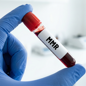 MMR Test (Measles, Mumps, Rubella)