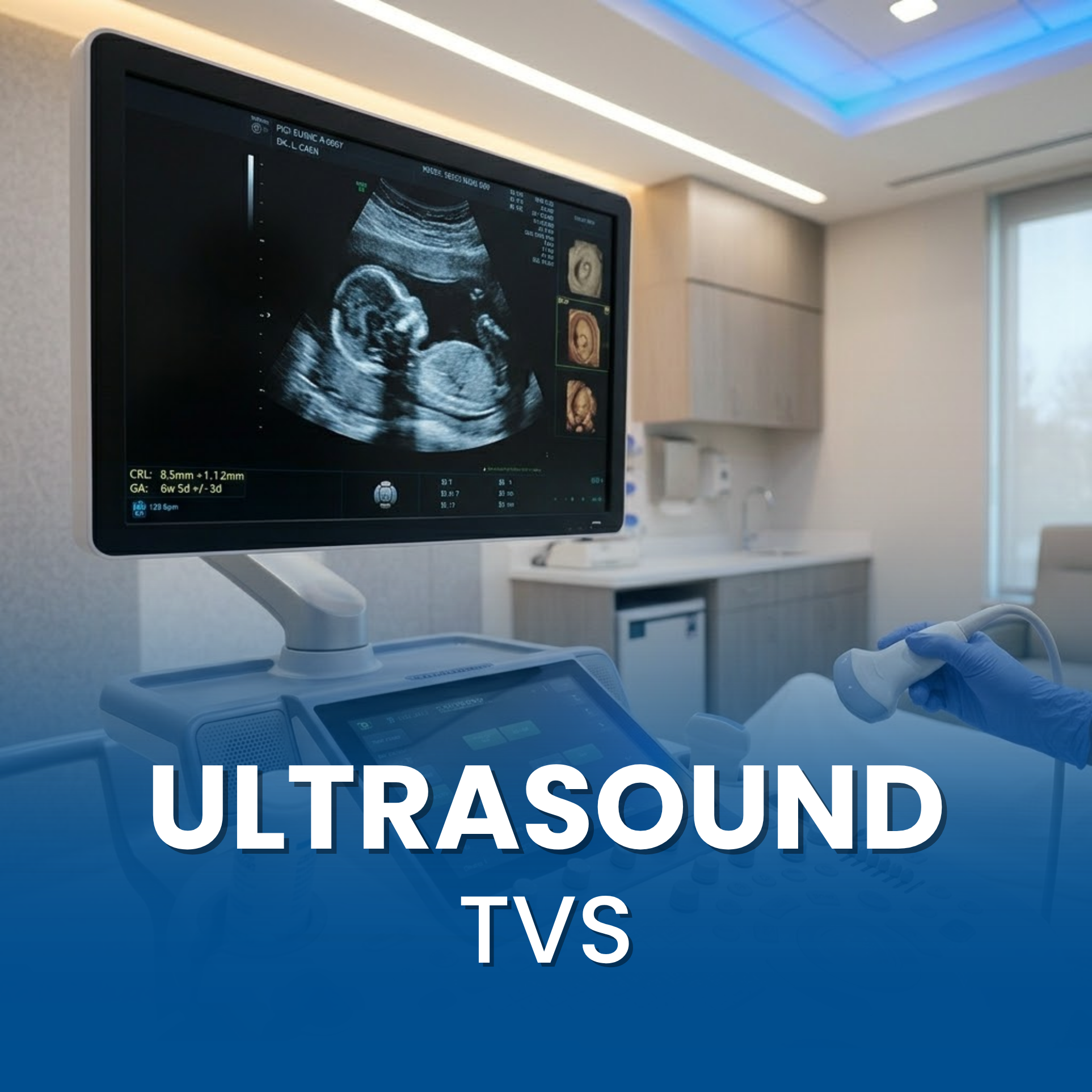 Ultrasound TVS (PORTABLE)