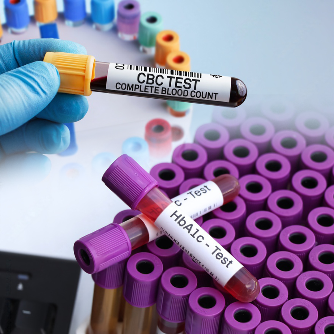 Diabetes Checkup Package - HbA1C with CBC and RBC