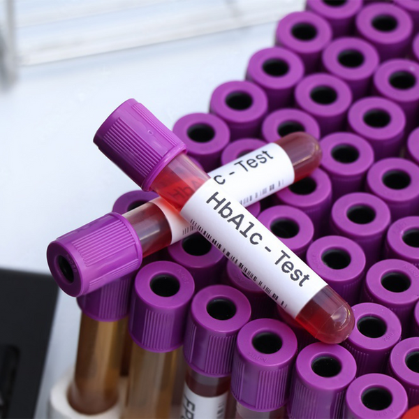 Glycated haemoglobin (HbA1c) - Blood Glucose