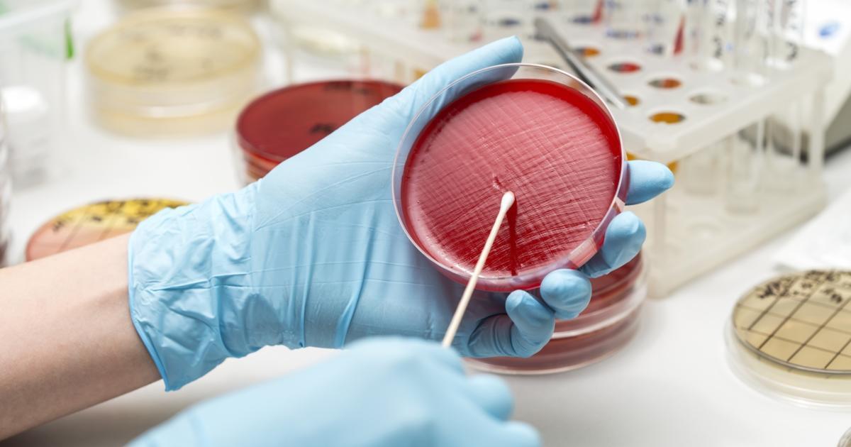 Culture & Sensitivity (Sputum)