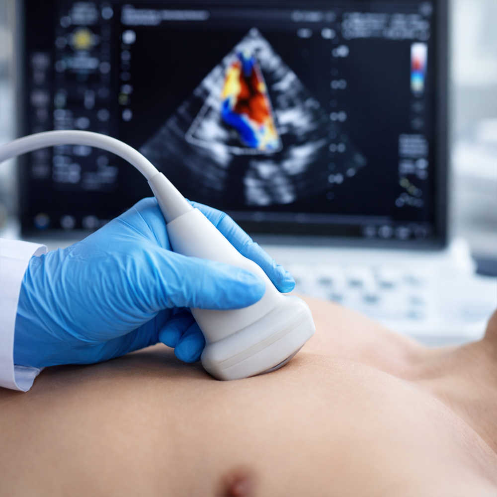 Echocardiography