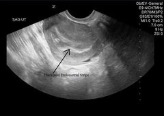 U/S Whole Abdomen + Testis