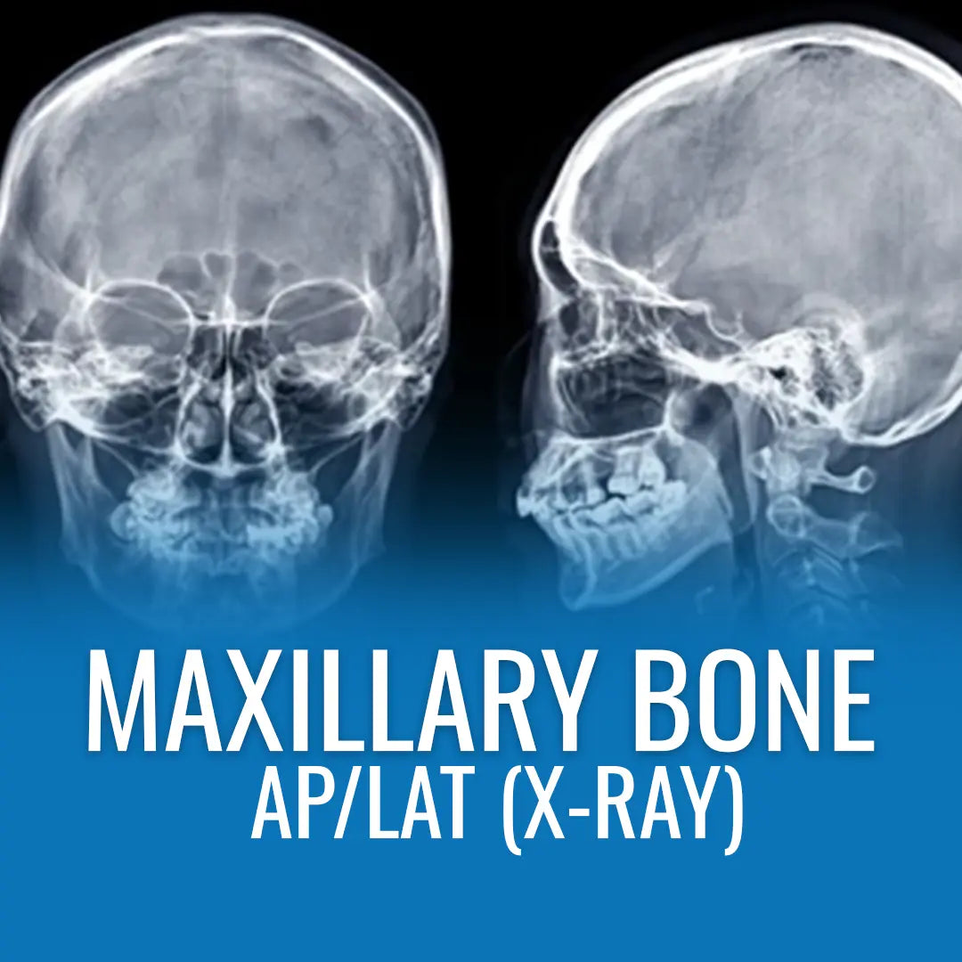 MAXILLARY BONE AP/LAT (X-RAY)