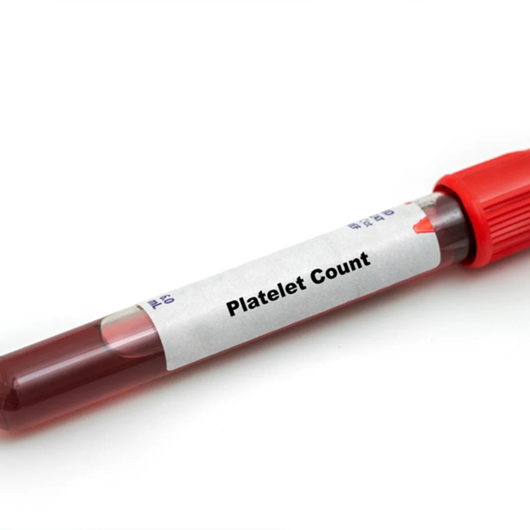 Lab test – EssaLaboratory