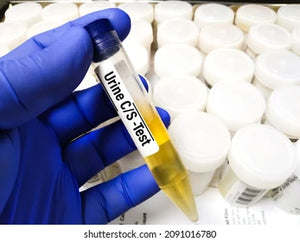 Culture & Sensivity (Urine)