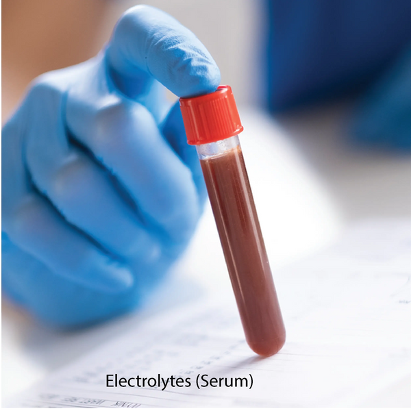 Electrolytes (Serum)