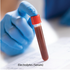 Electrolytes (Serum) Dr Essa Laboratory and Diagnostic Centre