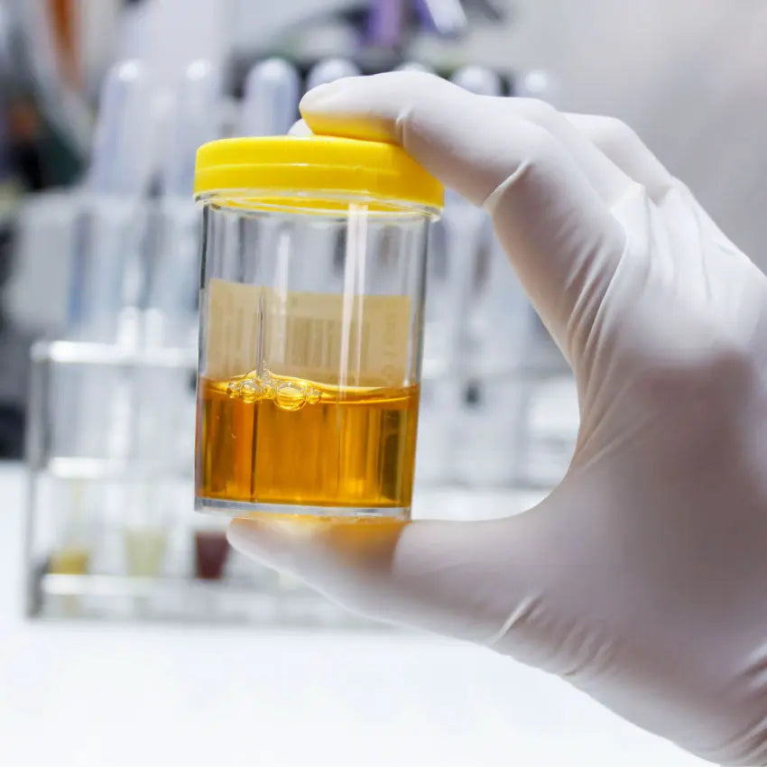 Electrolytes (Urinary)