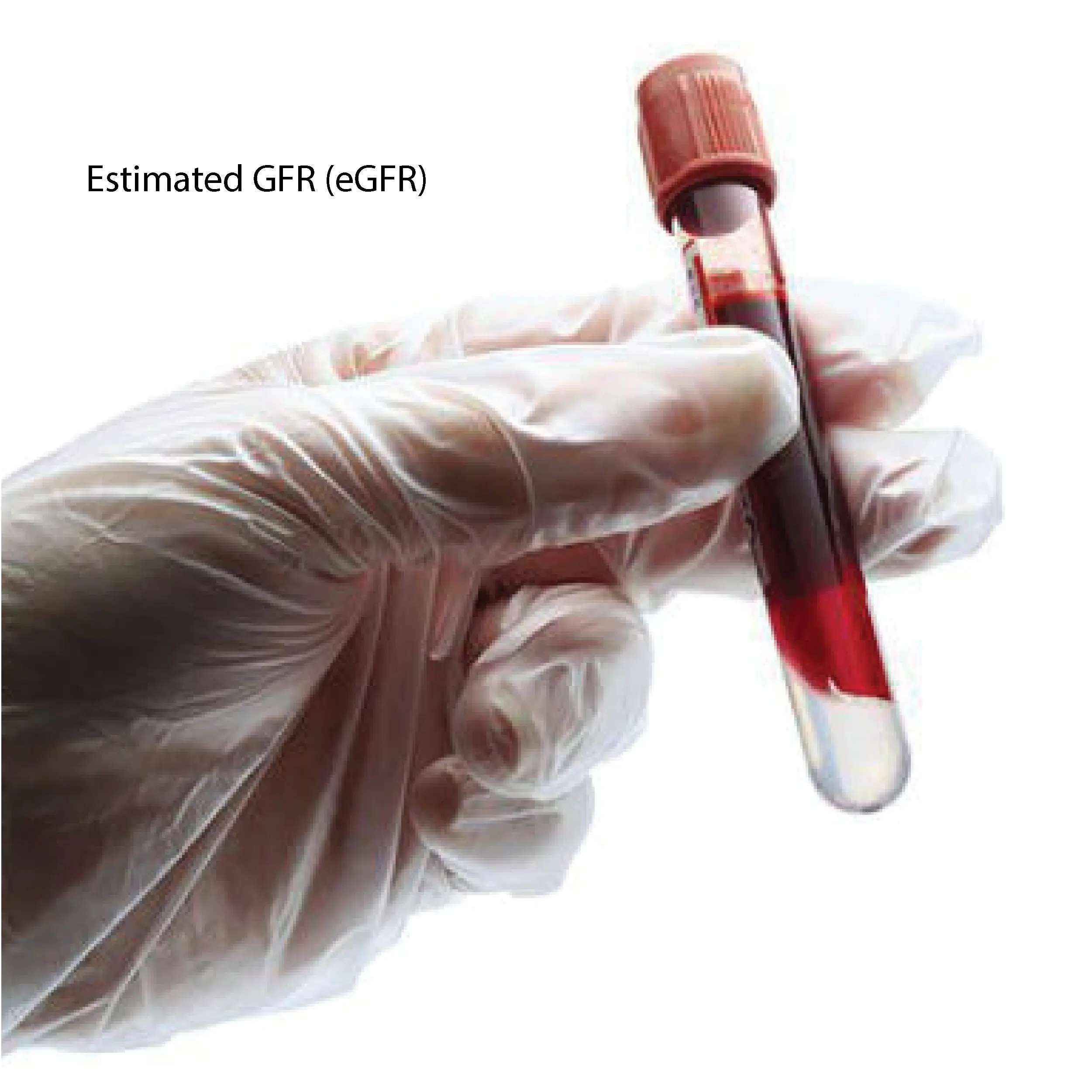 Estimated GFR (eGFR)