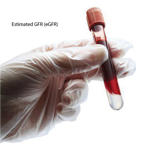 Estimated GFR (eGFR) Dr Essa Laboratory and Diagnostic Centre