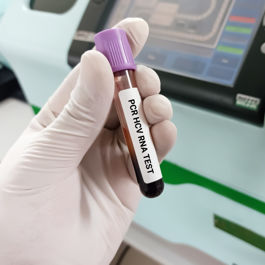 HCV RNA PCR (Quantitative)
