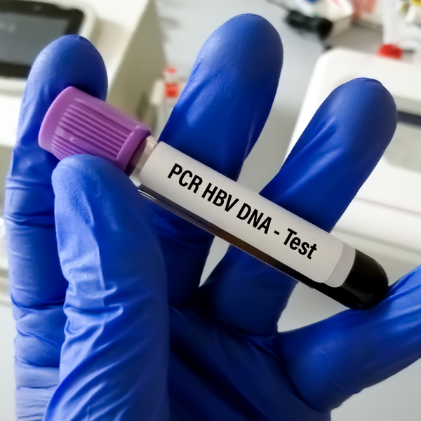 HBV DNA PCR (Quantitative)