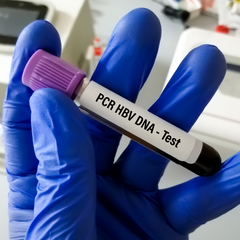 HBV DNA PCR (Quantitative)