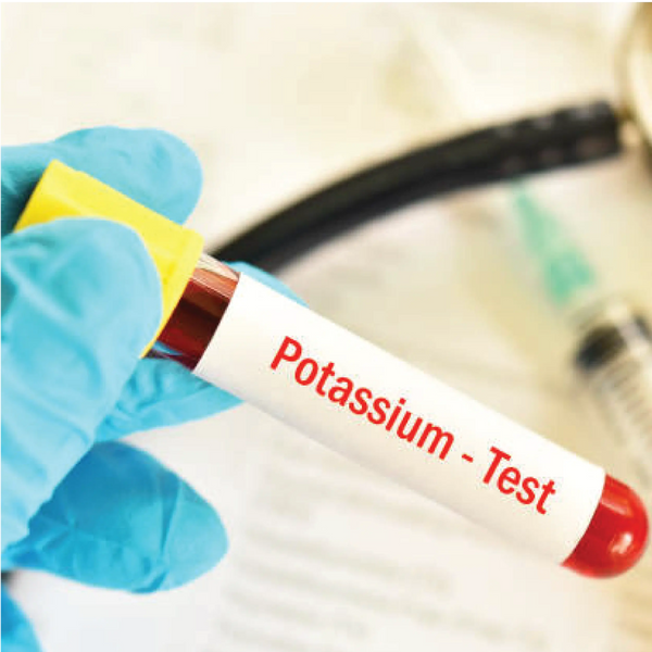 Potassium Dr Essa Laboratory and Diagnostic Centre