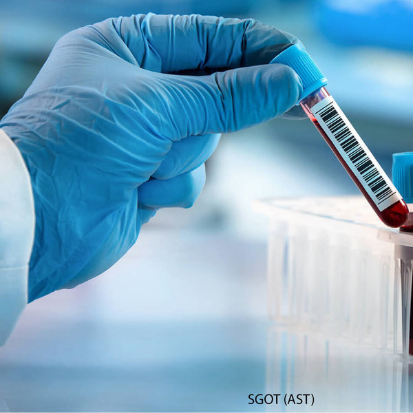 SGOT (AST) - Essa Laboratory – EssaLaboratory